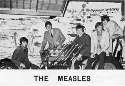 measles2